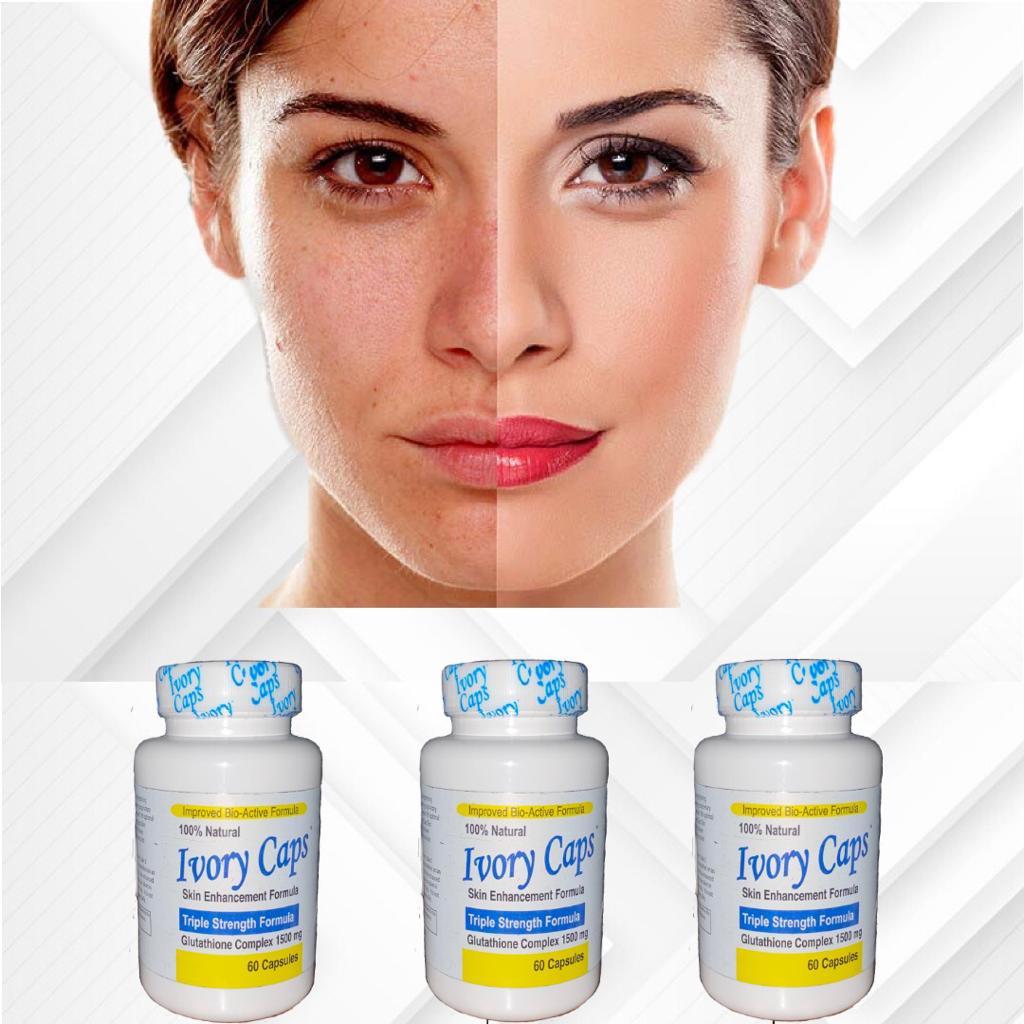 Ivory Caps - Image 2